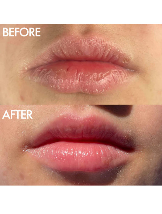 The Original 101 Ointment Duo